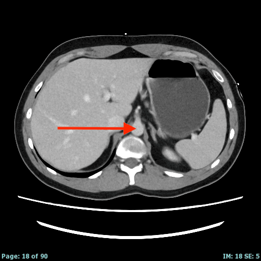 Real patient CT from the RADIX question bank