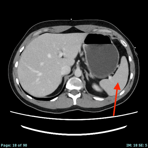 Real patient CT from the RADIX question bank