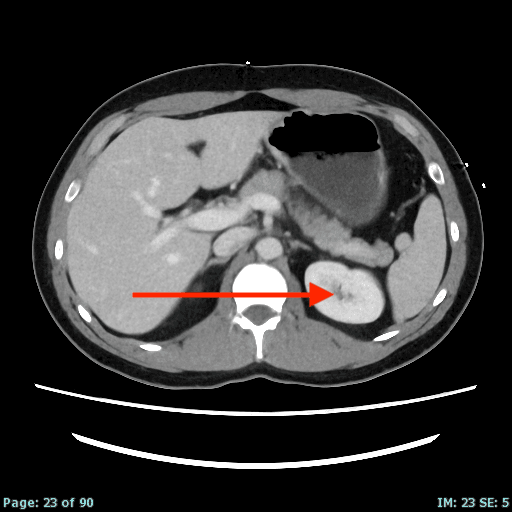 Real patient CT from the RADIX question bank