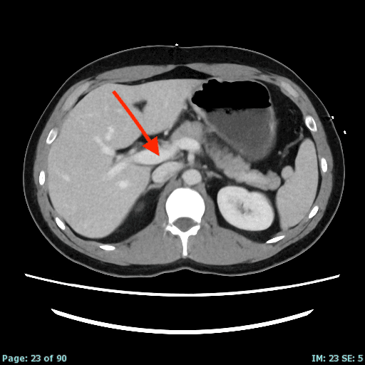 Real patient CT from the RADIX question bank
