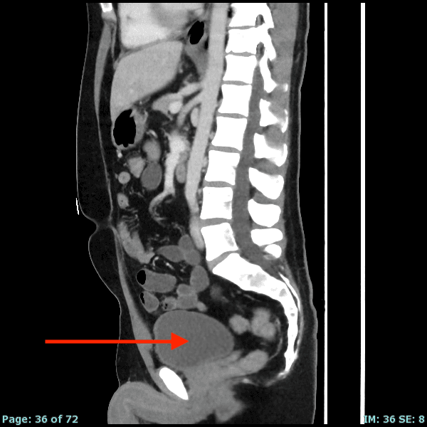 Real patient CT from the RADIX question bank
