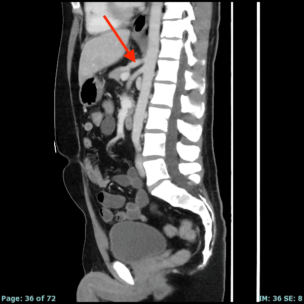 Real patient CT from the RADIX question bank
