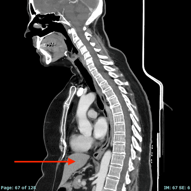 Real patient CT from the RADIX question bank