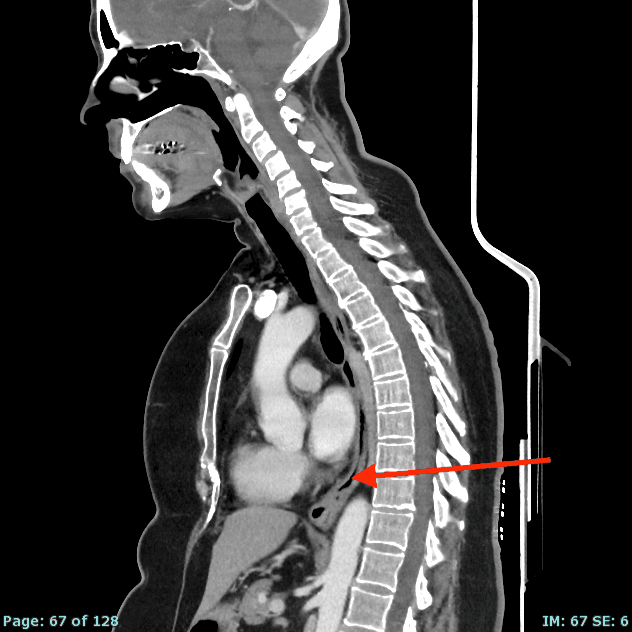 Real patient CT from the RADIX question bank