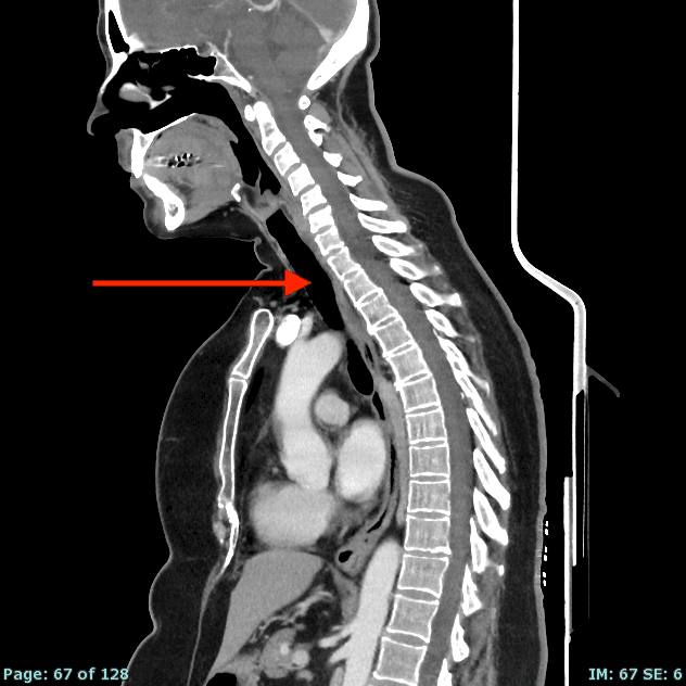 Real patient CT from the RADIX question bank