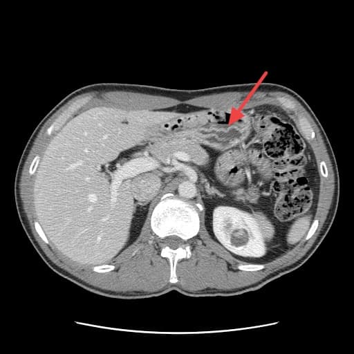 Real patient imaging from the RADIX question bank