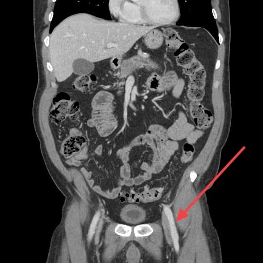 Real patient imaging from the RADIX question bank