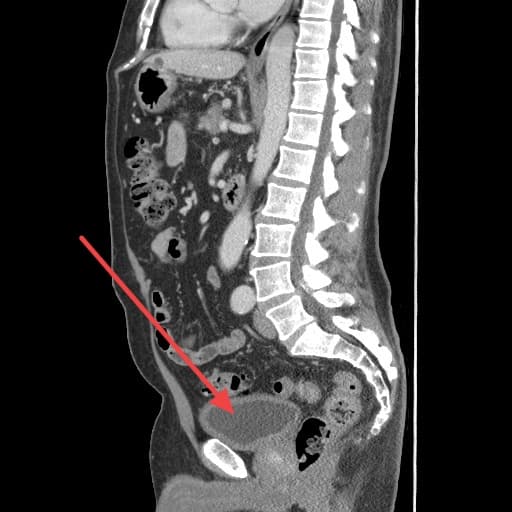 Real patient imaging from the RADIX question bank