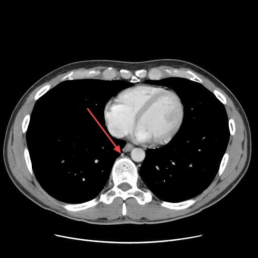 Real patient imaging from the RADIX question bank