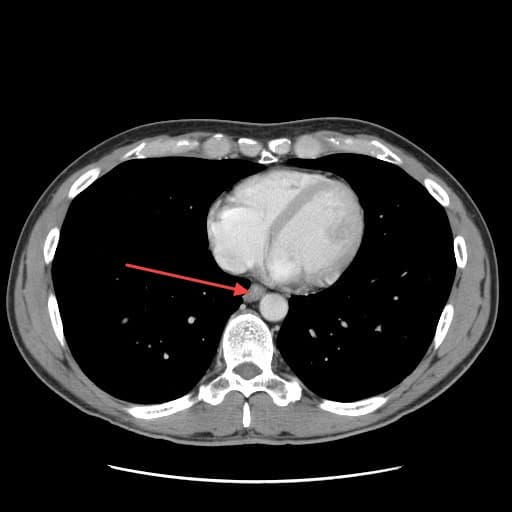 Real patient imaging from the RADIX question bank