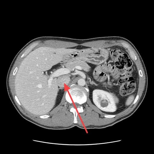 Real patient imaging from the RADIX question bank