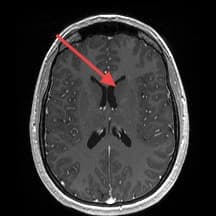 Real patient imaging from the RADIX question bank