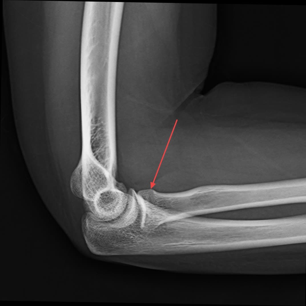 Real patient imaging from the RADIX question bank