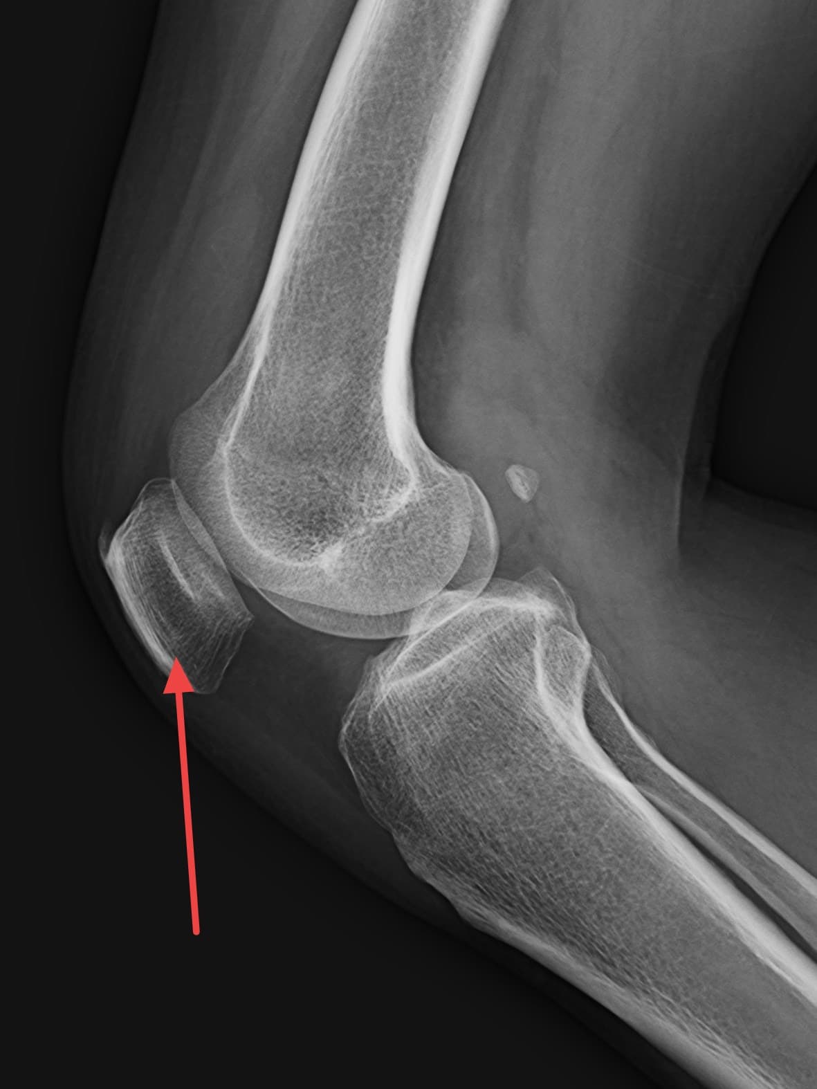 Real patient imaging from the RADIX question bank