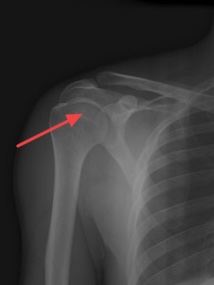 CR1 simulation question