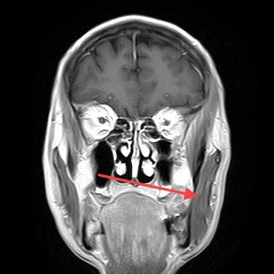 Real patient imaging from the RADIX question bank